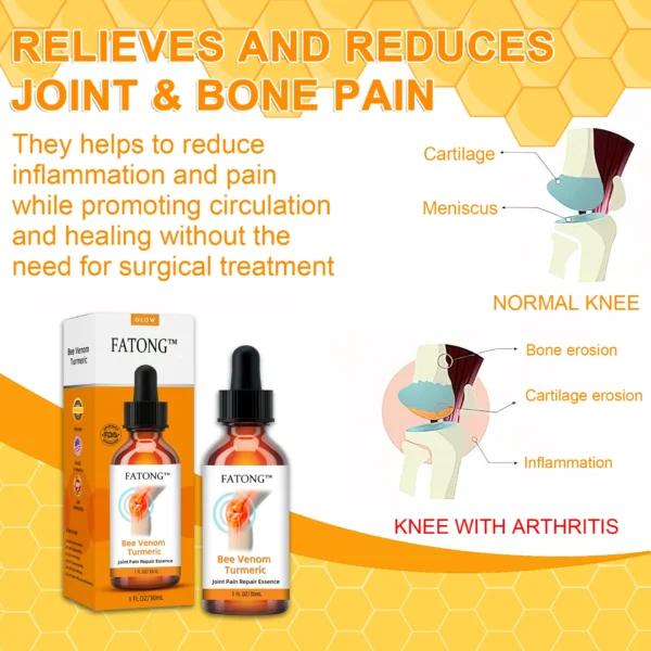 Fatong™ Bee Venom Turmeric Joint Pain Relief Repair Serum