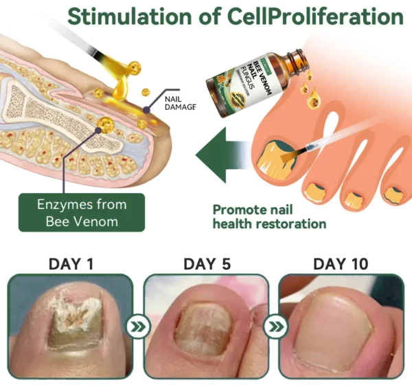 CVREOZ™ Bee Venom Nail Fungus Treatment Solution