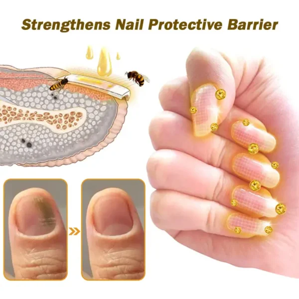 CVREOZ™ Nail Fungus Bee Venom Treatment Serum