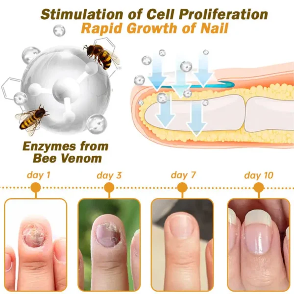 CVREOZ™ Nail Fungus Bee Venom Treatment Serum