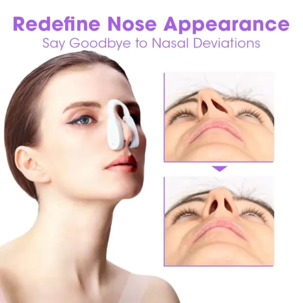 Fivfivgo™ Nose Sculpting Device