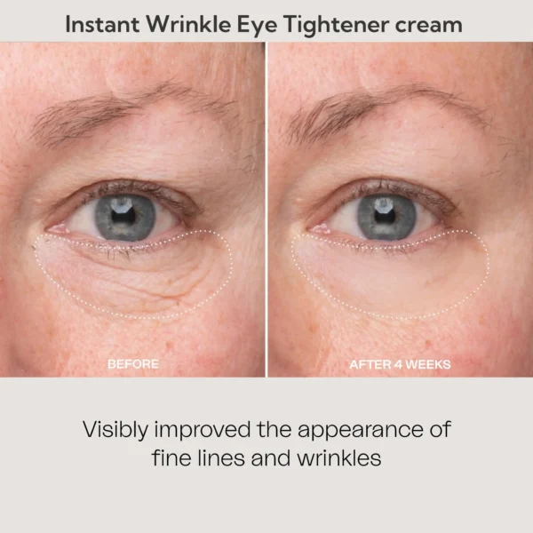 LOVILDS™Instant Wrinkle Eye Tightener Cream