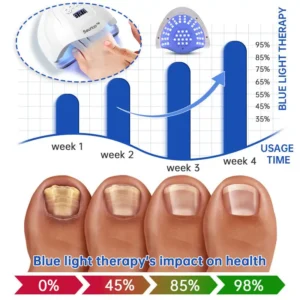 Seurico™ PureNail Fungus Laser Device