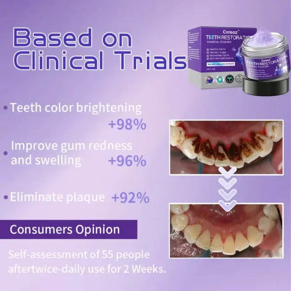 Cvreoz™ Teeth Restoration Mineral Powder