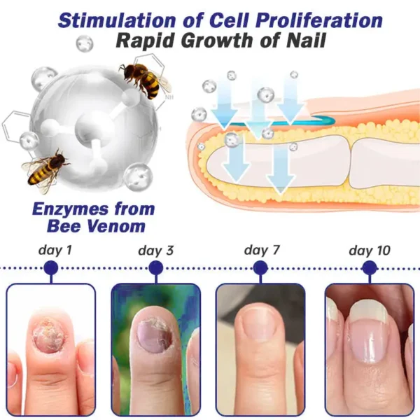 FURZERO™ Multi-Purpose Nail Repair