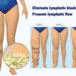 SIE𝖭𝖮𝖵𝖠™ Portable Lymphatic Detox And Joint Relaxation Therapy Device