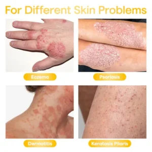 SkinAura Honey Eczema Soothing Cream